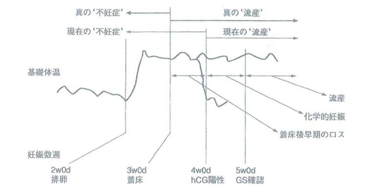 流れＬｏｗｓ